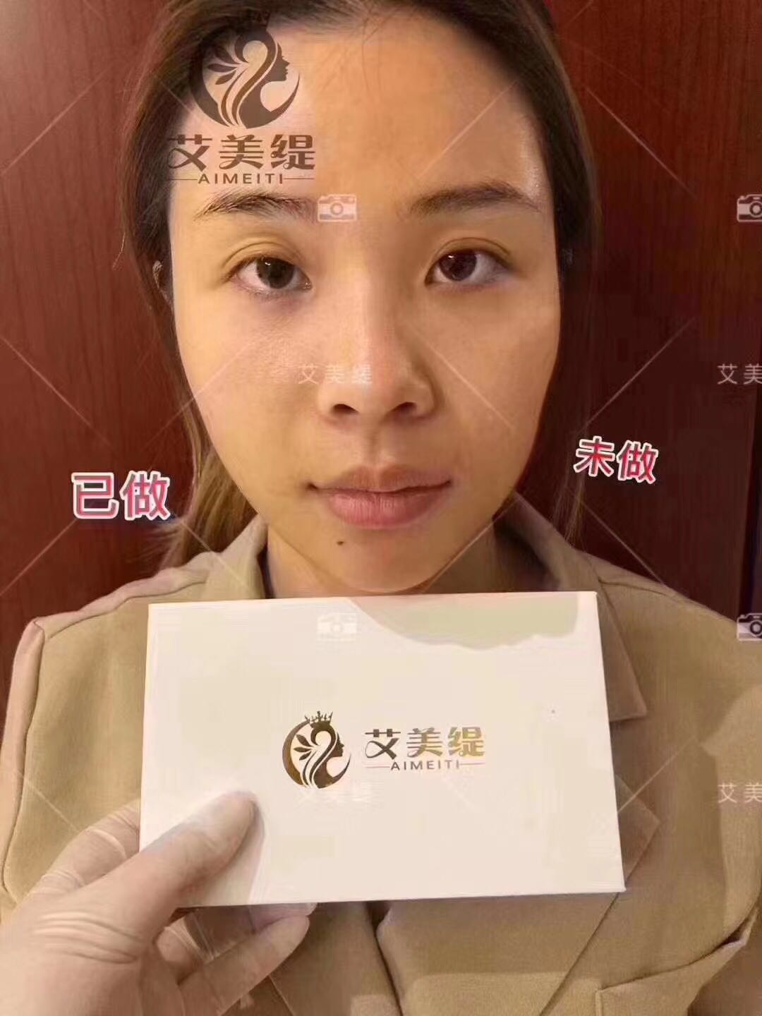 艾美缇