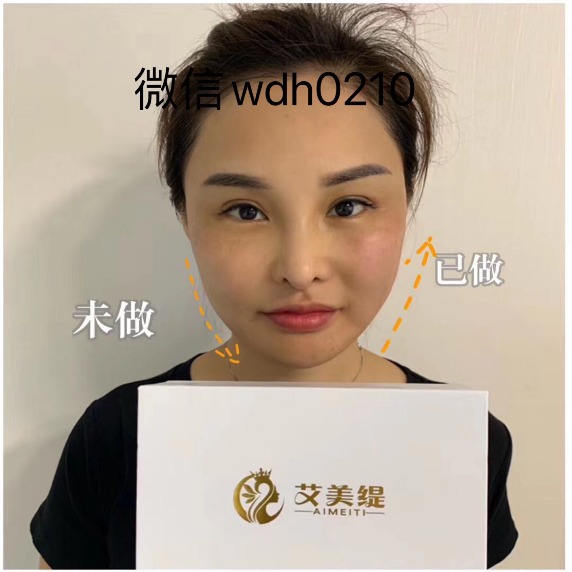 什么是艾美缇？艾美缇的成分是什么？艾美缇的原理？