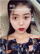 十九歲做艾美緹（艾美緹ST筋膜再植）早嗎，臉有點(diǎn)大打sl針效果不是很好。