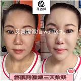 哪有什么天生麗質(zhì)，只是比你美的人都做過艾美緹