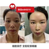 璣源皙細胞美療是什么？璣源皙細胞美療貴嗎？璣源皙細胞美療怎么加盟的？璣源皙細胞美療效果確實驚人？