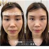 璣源皙干細胞不滿意能不能取出來？璣源皙干細胞能管幾年？璣源皙干細胞想投資加盟可以找誰