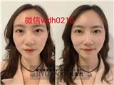 璣源皙細胞美療能維持多久 璣源皙細胞美療能去眼袋嗎璣源皙細胞美療效果好嗎璣源皙細胞美療有副作用嗎璣源皙細胞美療多少錢  璣源皙細胞美療的操作方法璣源皙細胞美療是什么意思璣源皙細胞美療的原理