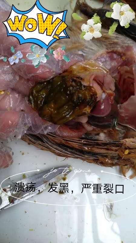 腺肌胃炎发病时间 症状 预防方案