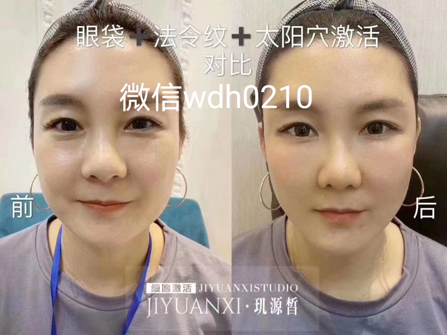 玑源皙美疗细胞学什么